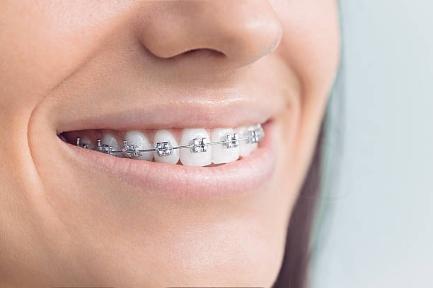 Best Full Mouth Reconstruction  in Whitewater, KS